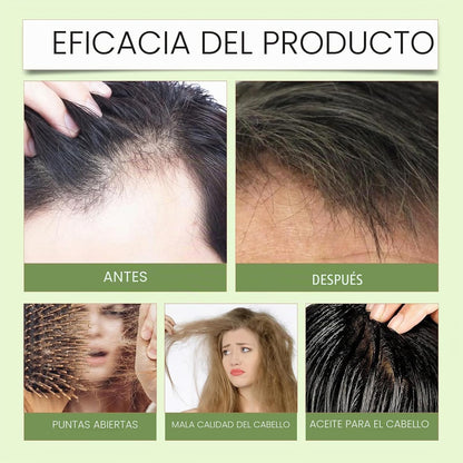 Champú de romero, jabón para el crecimiento del cabello.